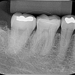 Endodontia